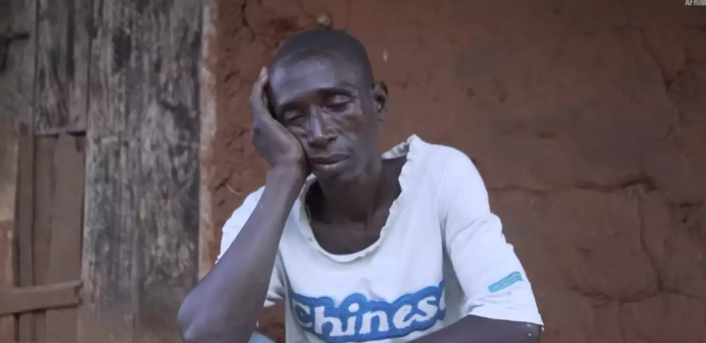 He now lives a solitary life after his unusual ordeal (Afrimax English/YouTube)
