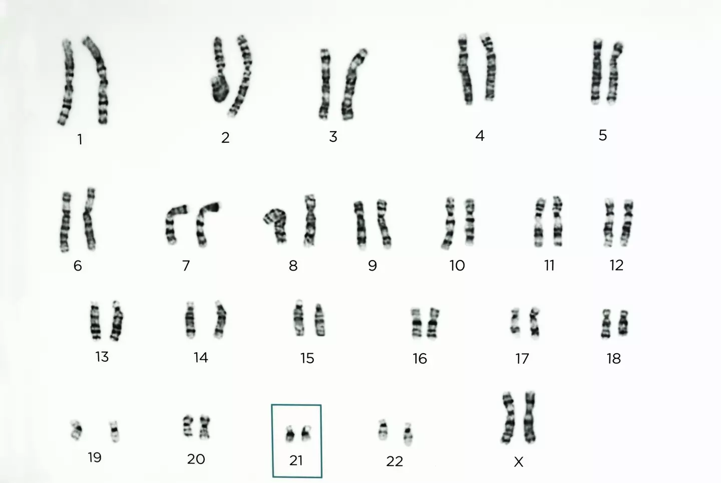 Scientists believe that the Y chromosome has degraded over time.