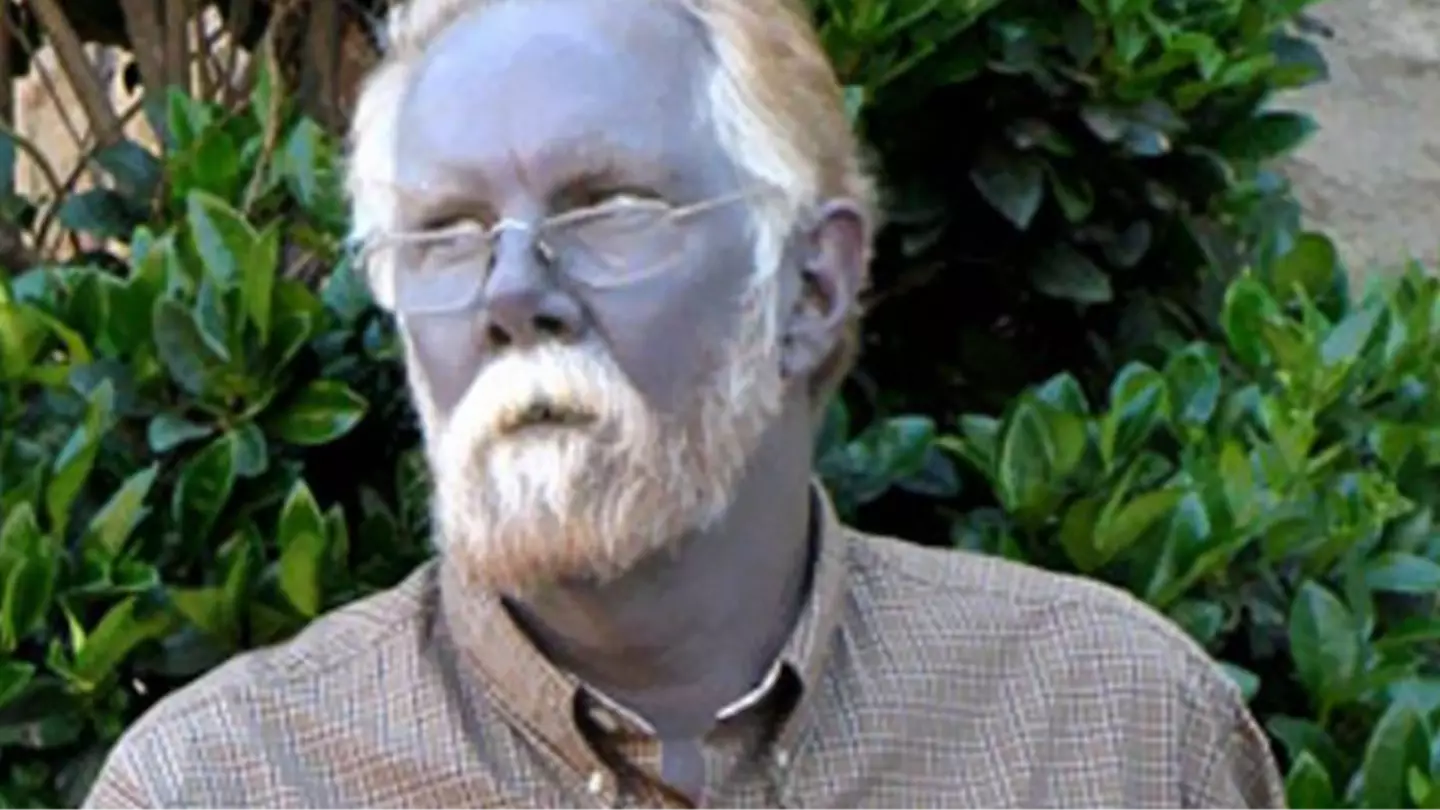 Bizarre case of man who suffered horrific side-effect and turned himself permanently blue