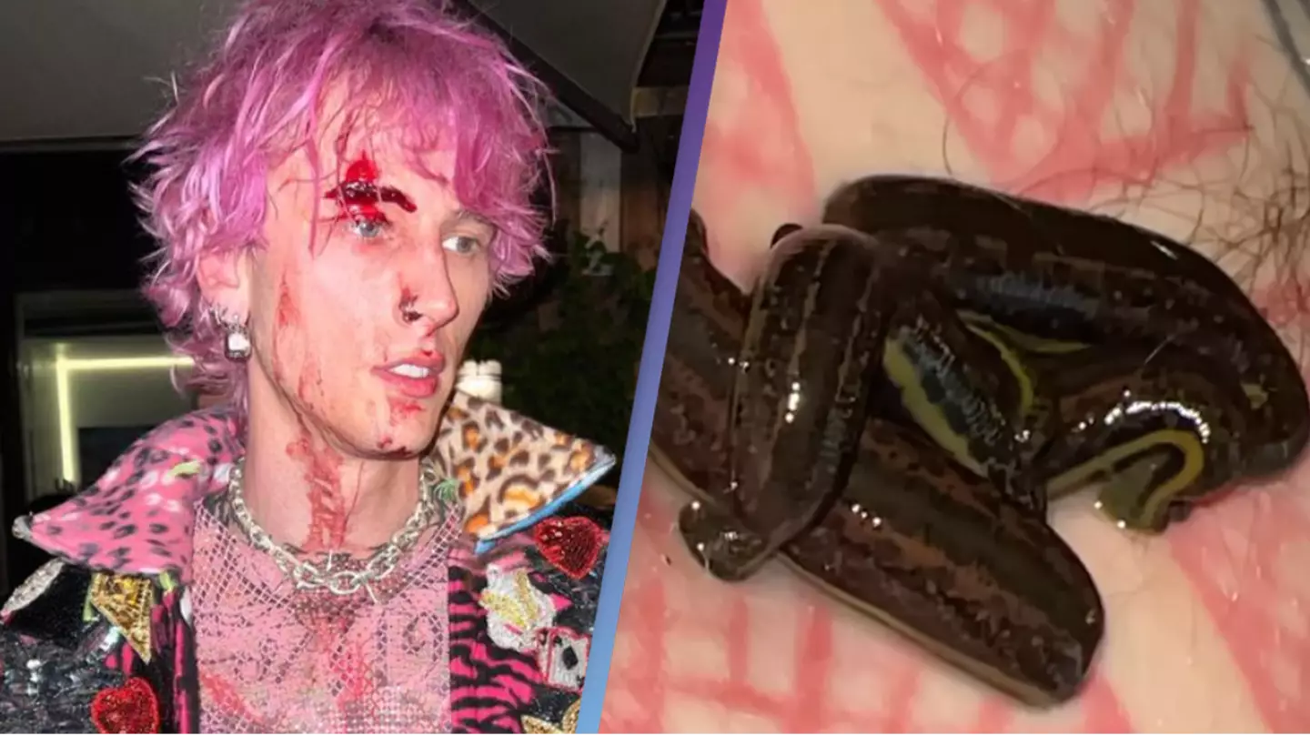 Machine Gun Kelly says he's 'best friends' with leeches