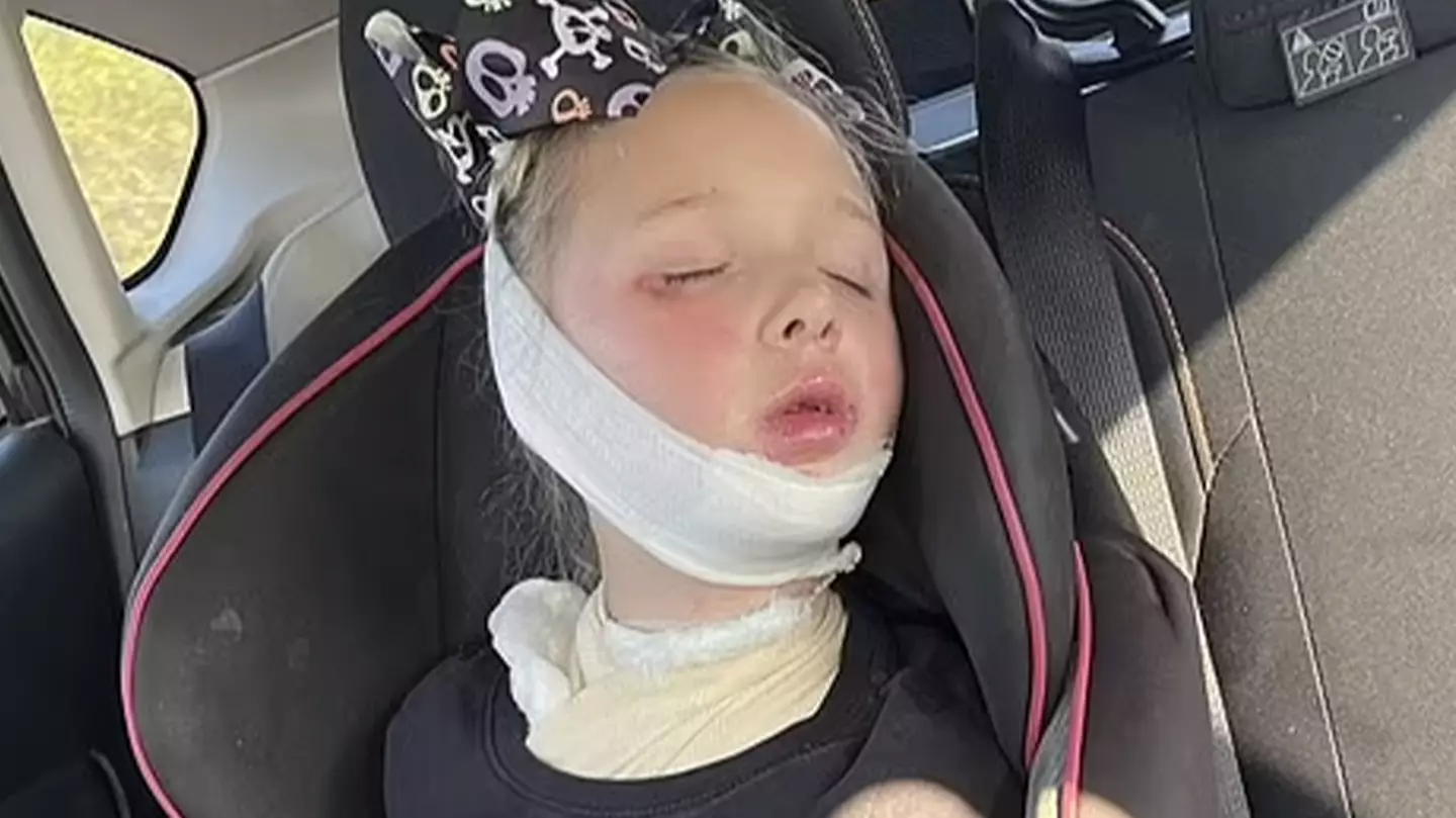 Scarlett sustained second and third-degree burns (Kennedy News and Media)