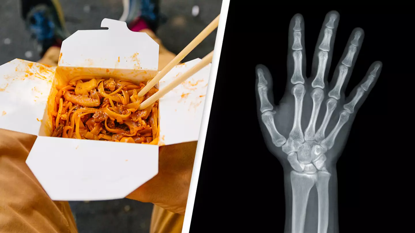 Student lost all his limbs after eating his roommate’s leftover food