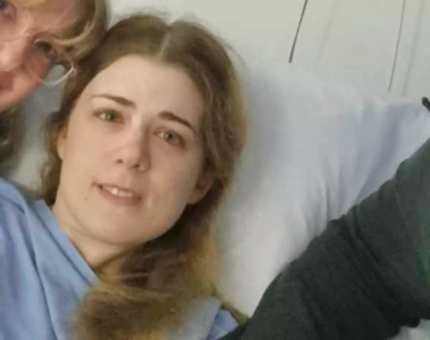 The condition typically affects the face (GoFundMe)
