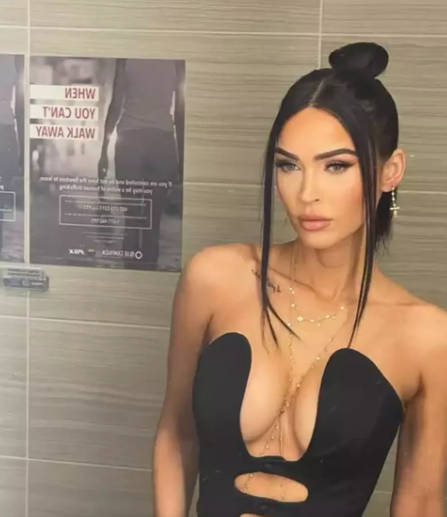 Megan Fox said she is not ‘embarrassed’ about having brachydactyly.