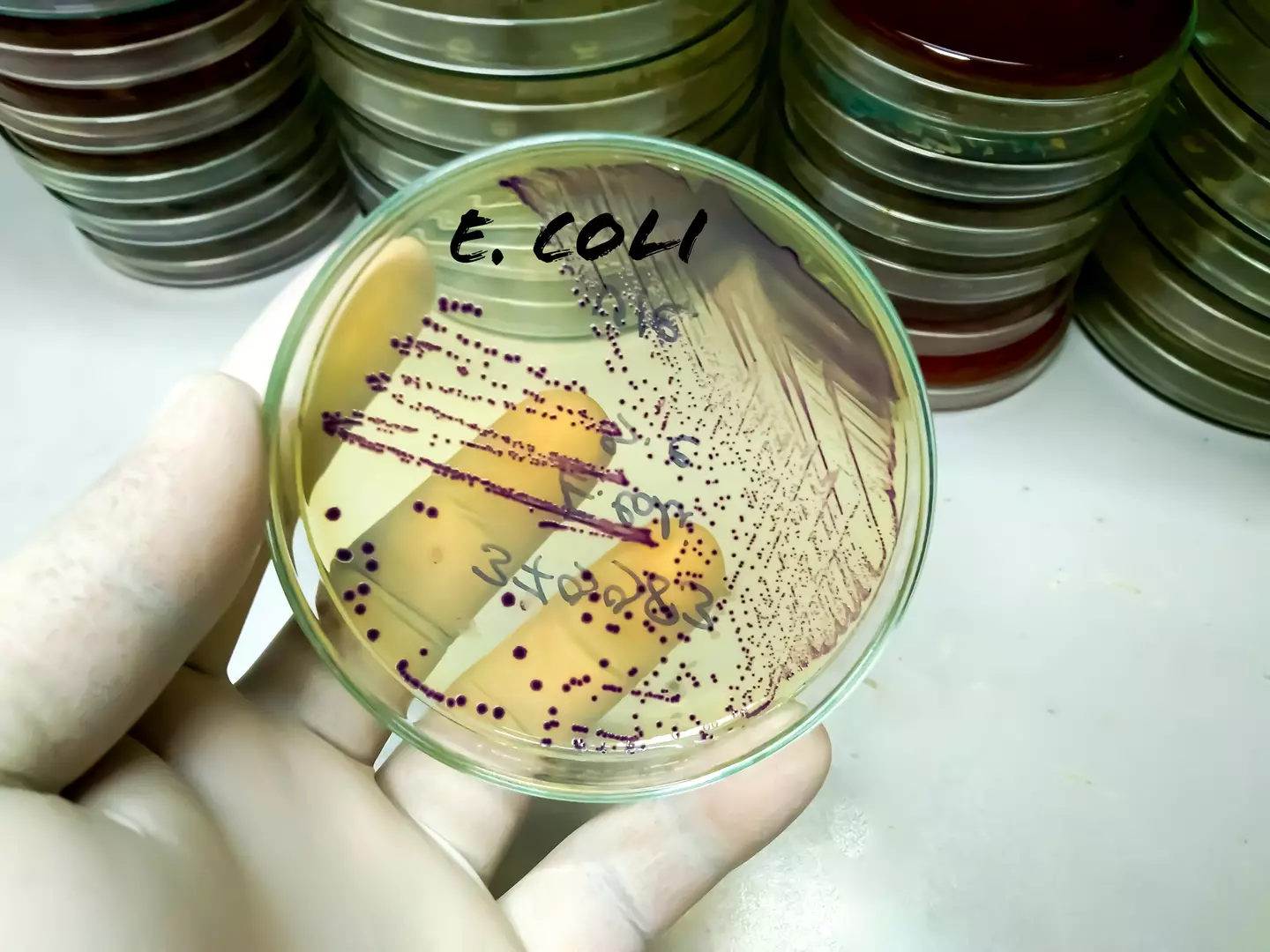 Christine's tests found traces of E.coli (Getty Stock Image)