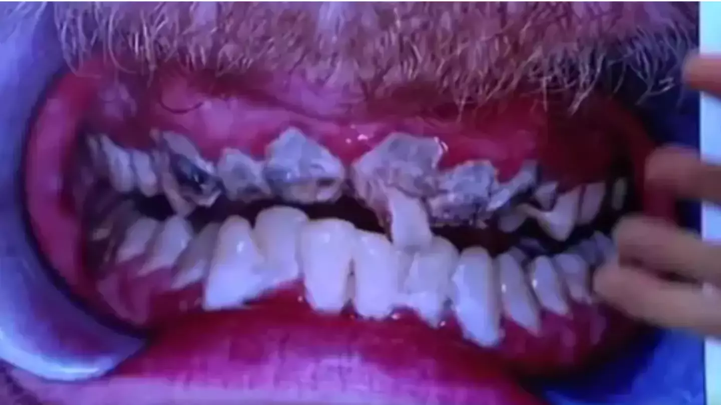 Jay had a diet of fizzy drinks. Credit:Channel 4/Embarrassing Bodies