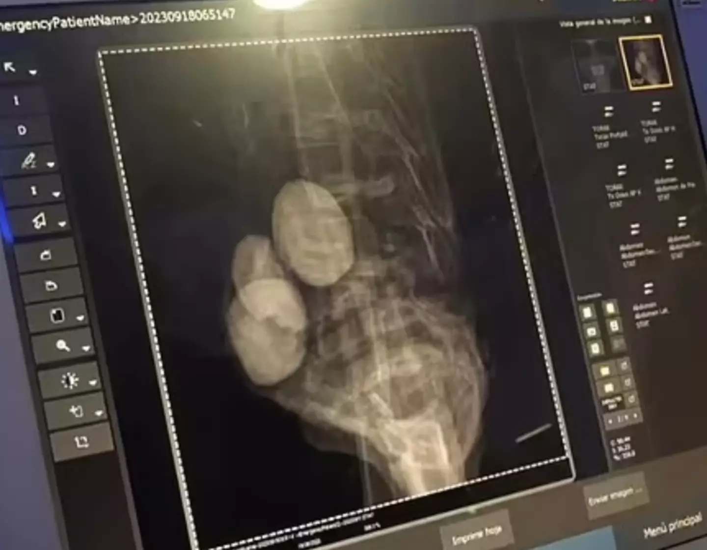 The scientists pointed to lumps in the abdomen which could be 'eggs'.