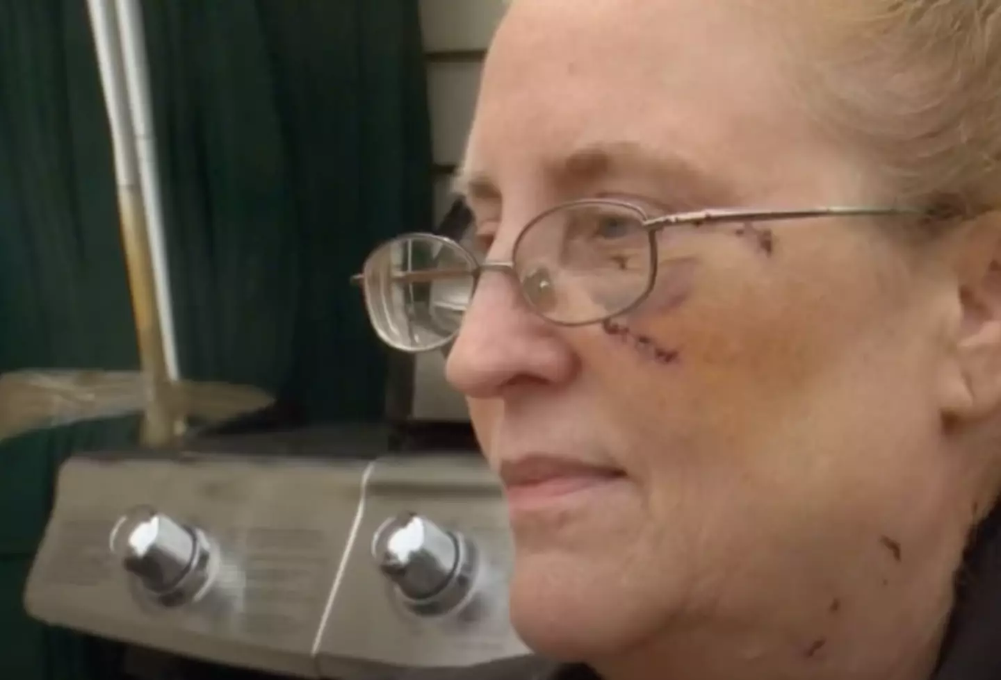 Karen remained remarkably calm while on the phone to 911 with the bear still behind her. (YouTube/ Inside Edition)