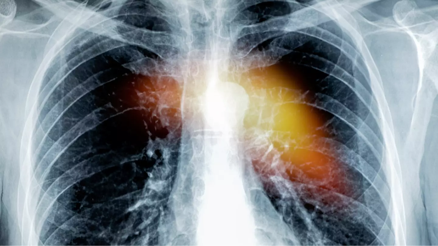 Getty Images/Jose A. Bernat Bacete