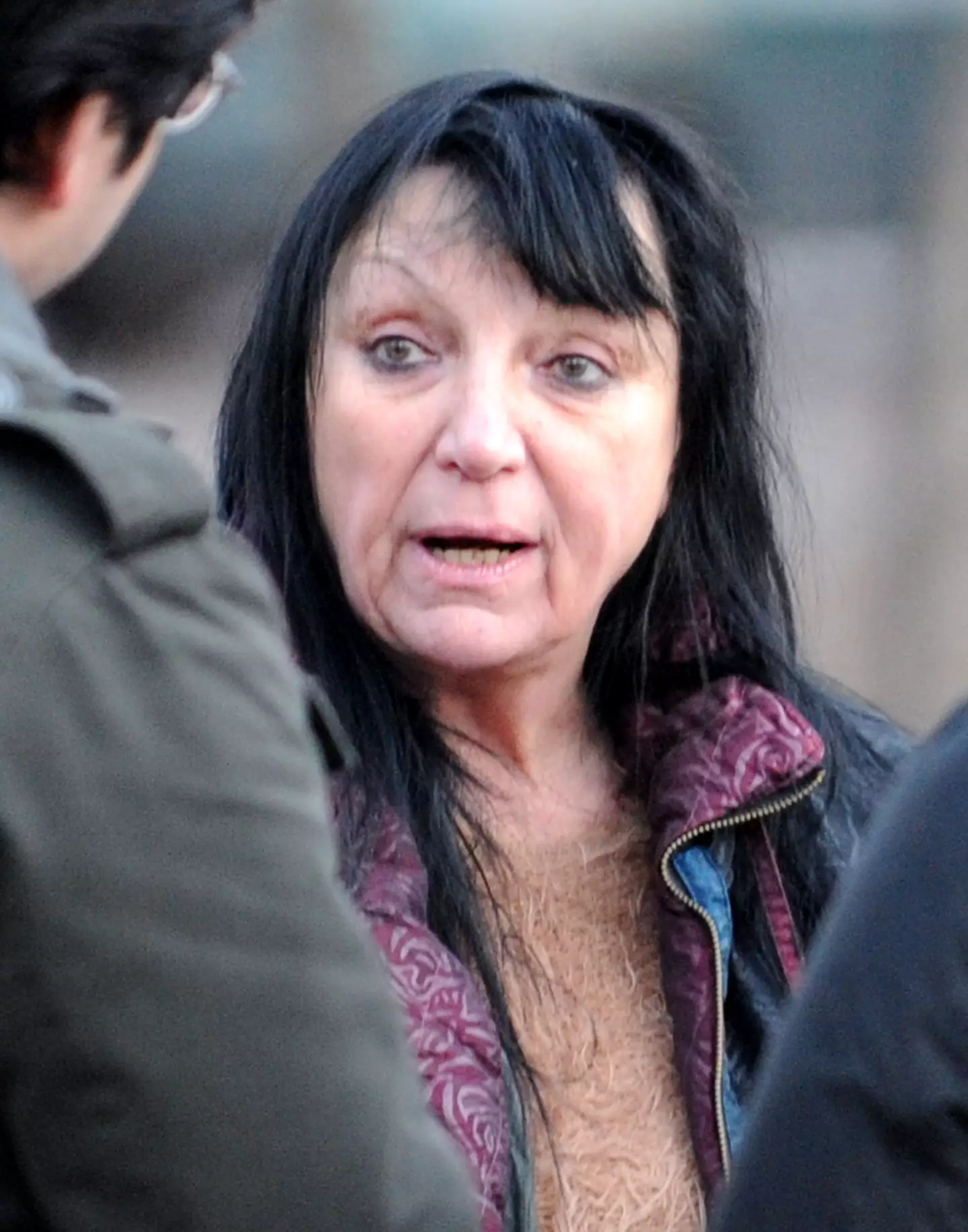 Brutal Chimp Attack: The Disturbing 911 Call You Need To Hear - ef1ru9q