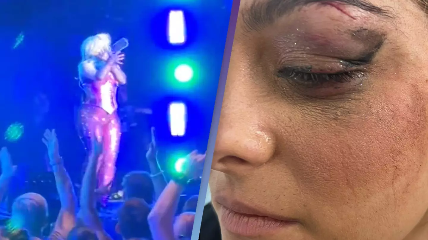 Man charged with hitting Bebe Rexha in the face with a phone did it because he thought it would be 'funny'