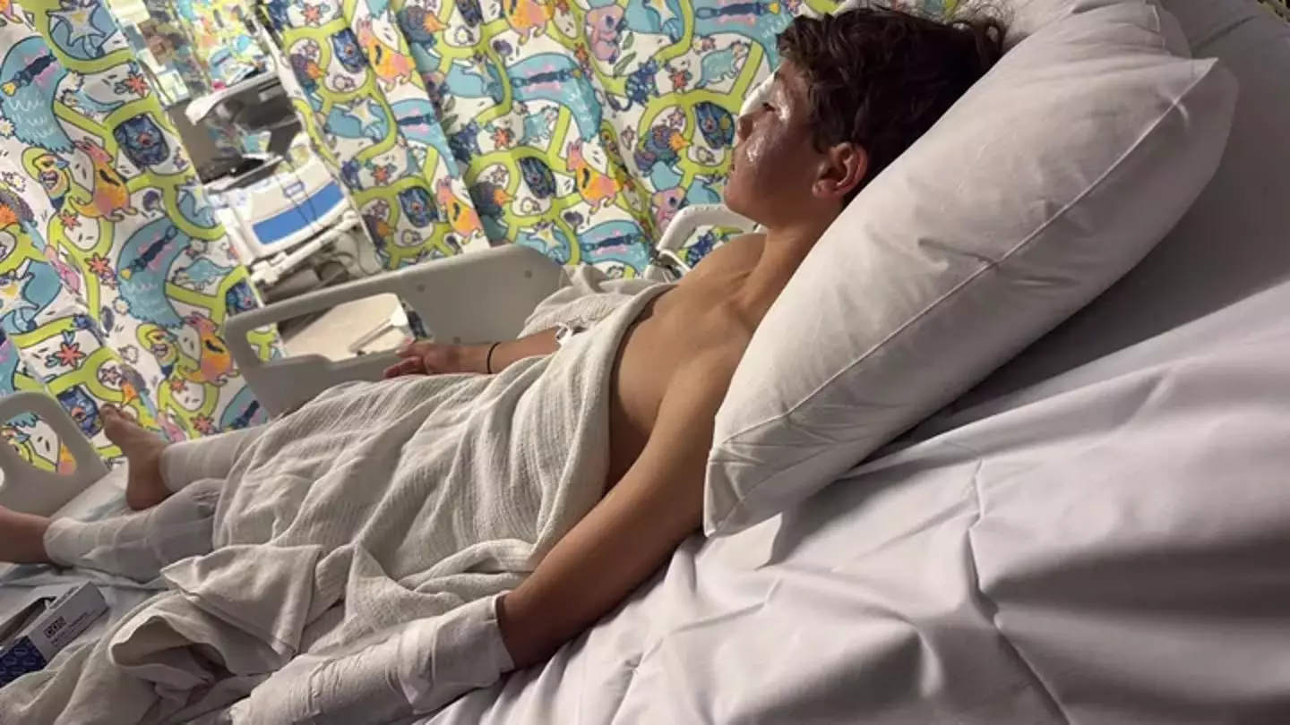 Lucas Baldock was called over to a group of boys at the local park who lit a deodorant can on fire (GoFundMe)