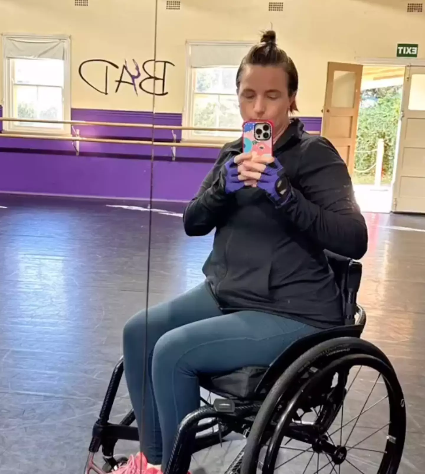 The mom now relies on a walking stick and wheelchair (Instagram/@imperfectlyperfectsugarcookies)