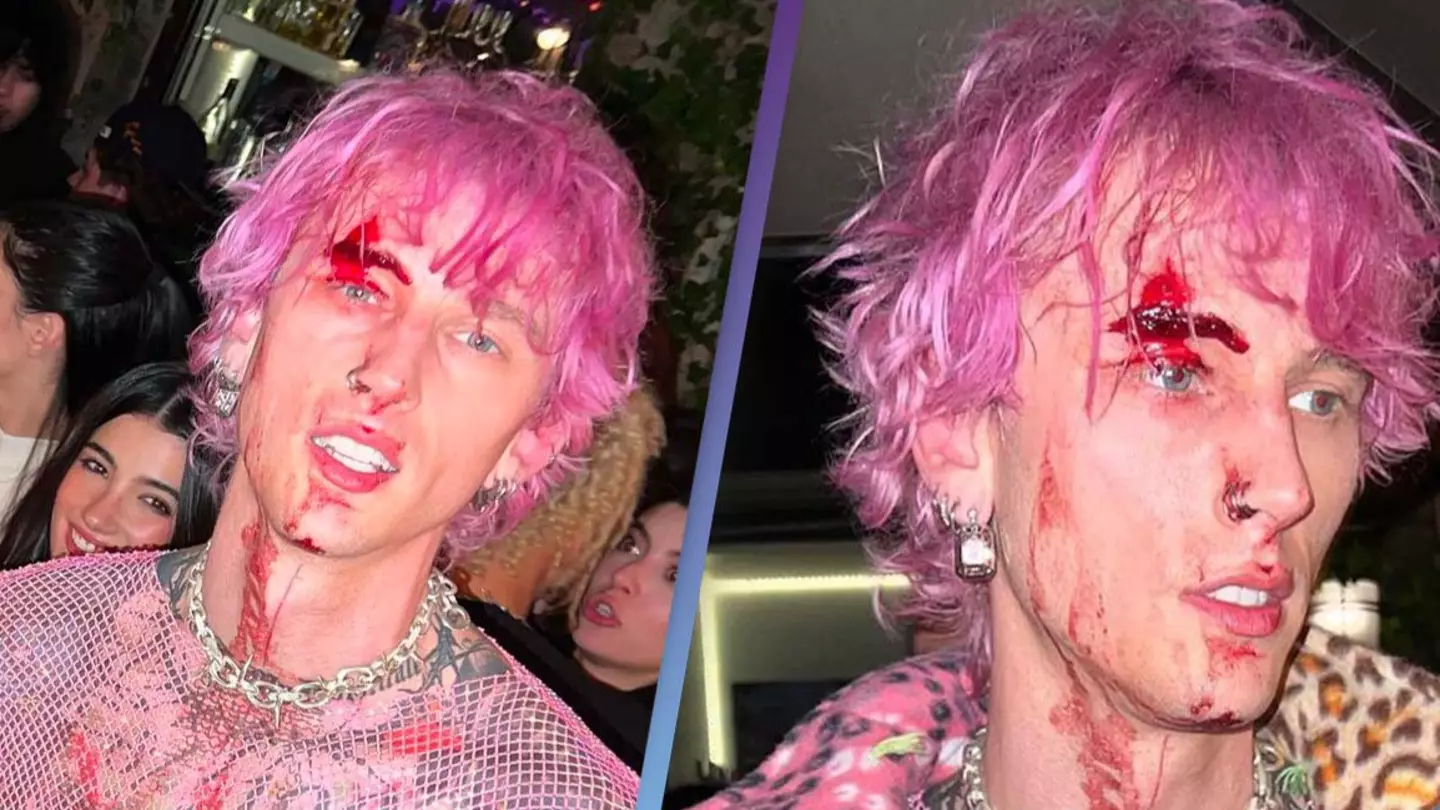 Machine Gun Kelly Shares Bloody Photos With Fans After Smashing Glass On His Face