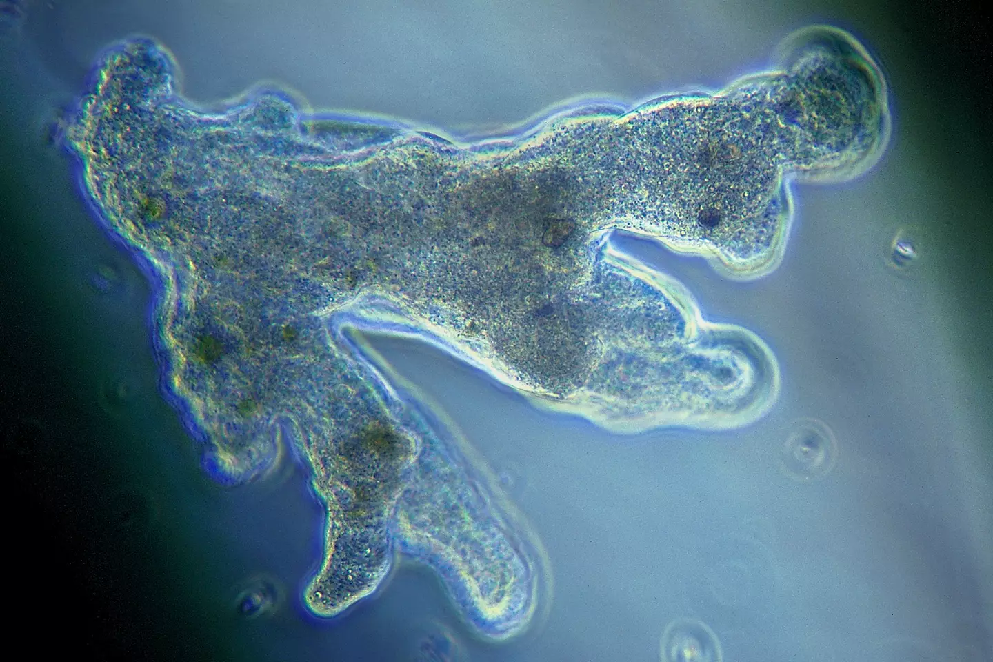 It's incredibly rare to die from the infection with only 37 cases ever in Florida.