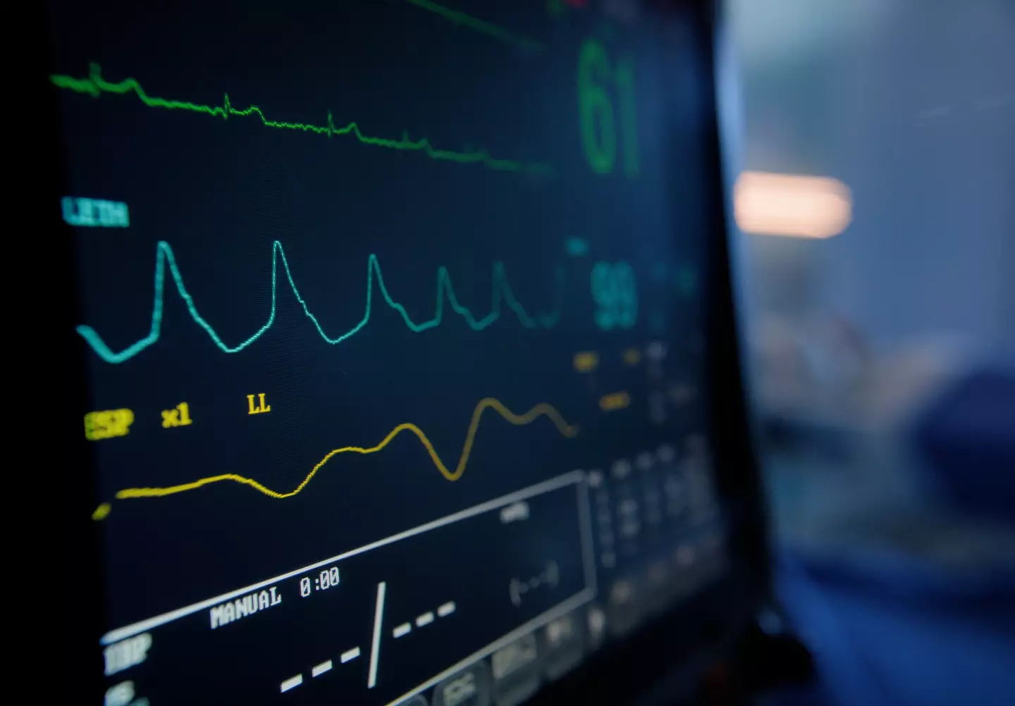 He needed a triple heart bypass (Getty Stock Image/Bevan Goldswain)