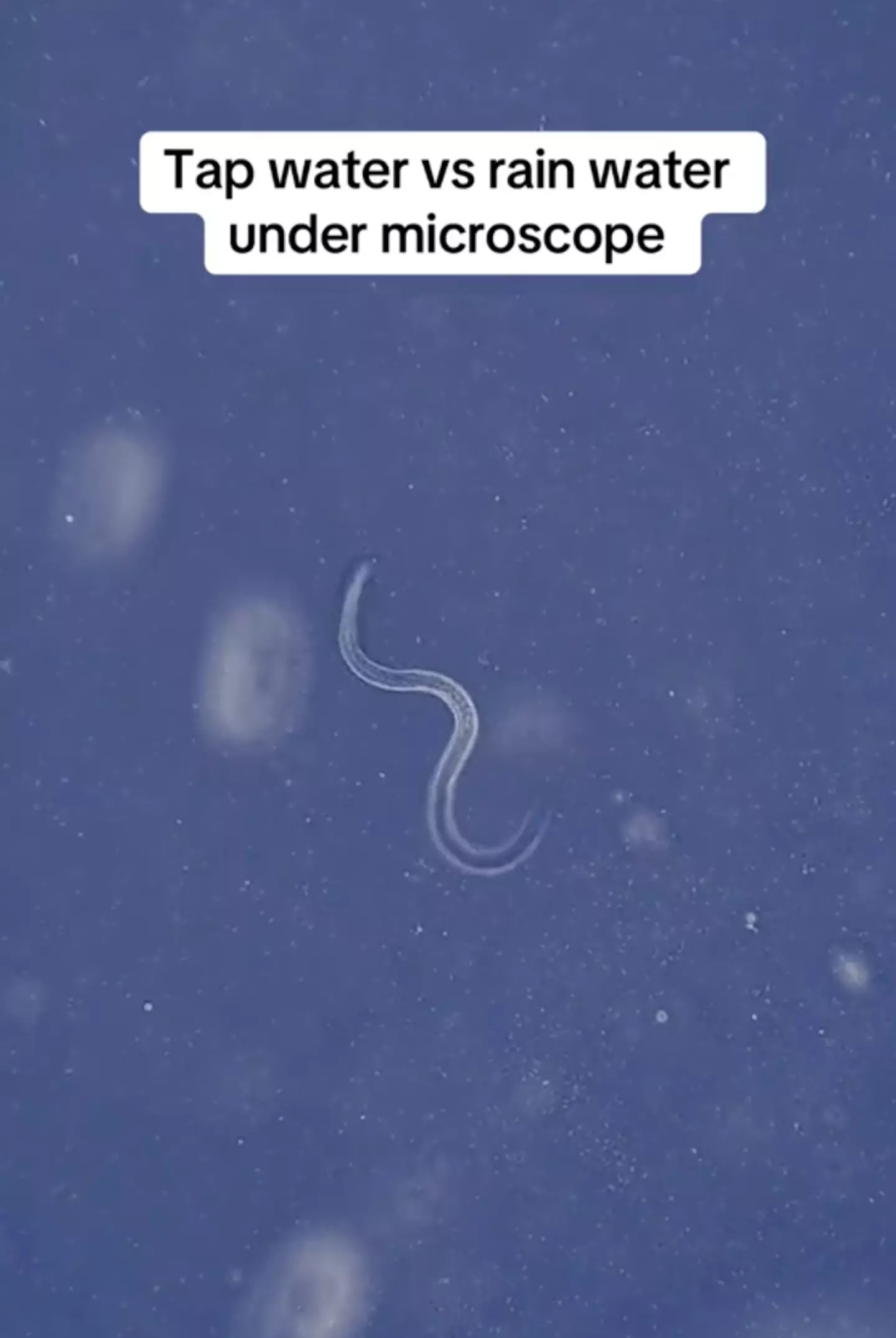 The rain water may have had parasites in it. (microscope.vision/TikTok)