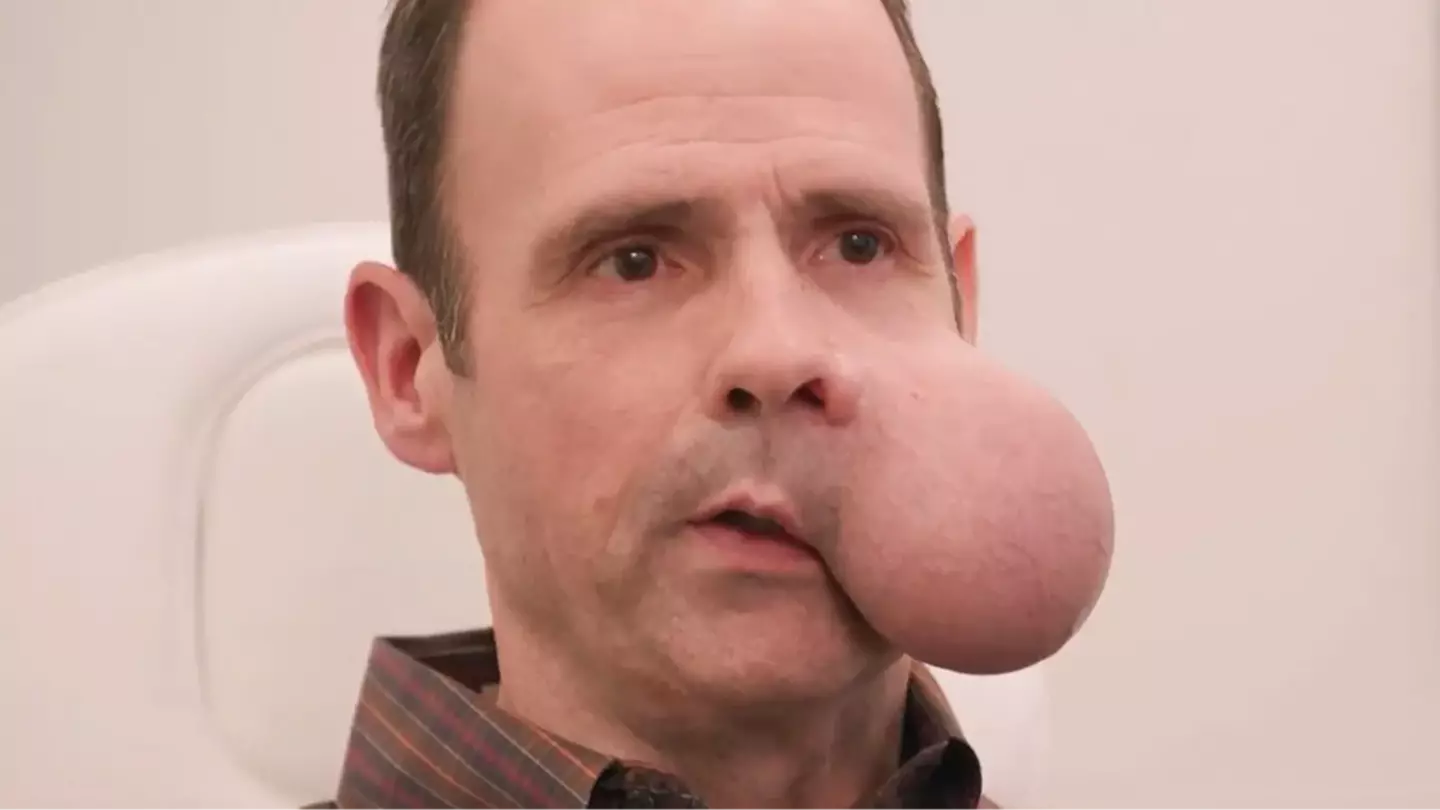 Man with 4-pound tumor on his face pleads for help as doctors issue deadly warning