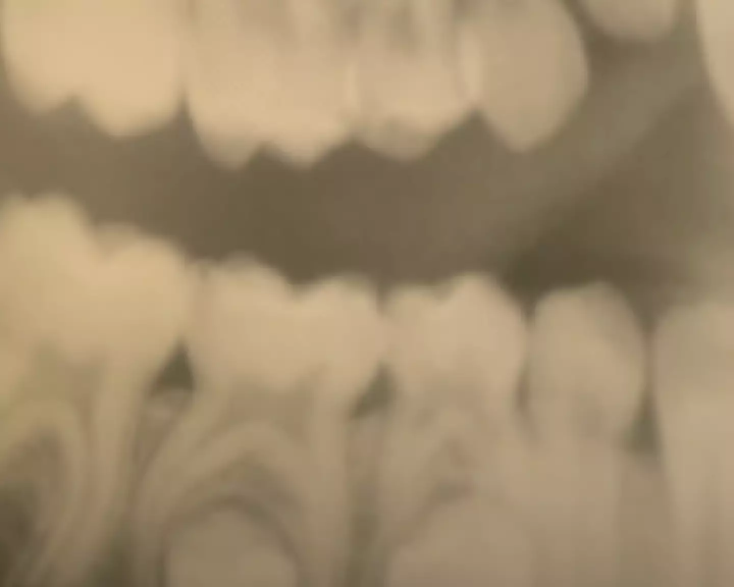 The dentist described the x-ray as 'definitive evidence'.