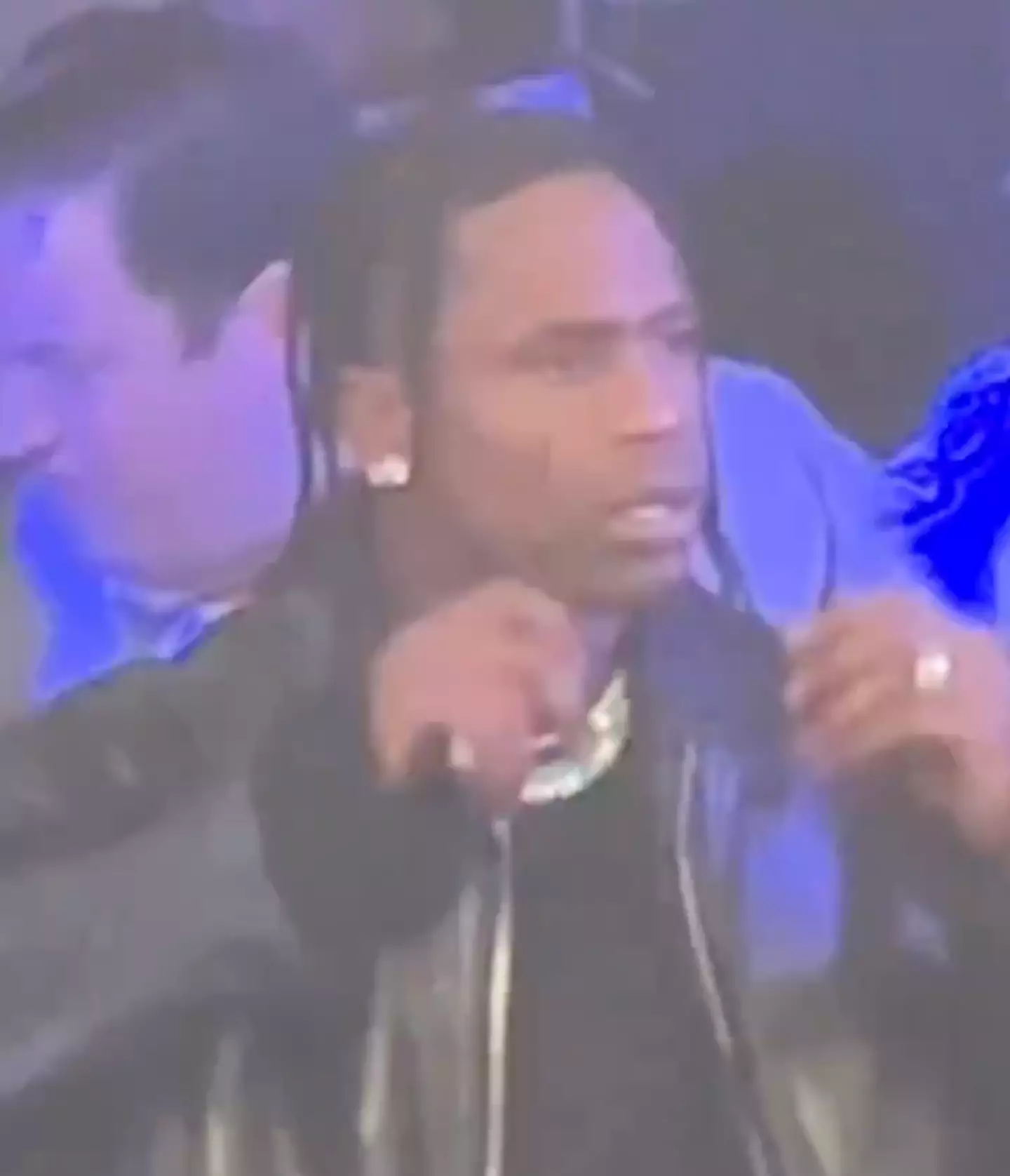 The music star removed his glasses as he pulled a befuddled face .