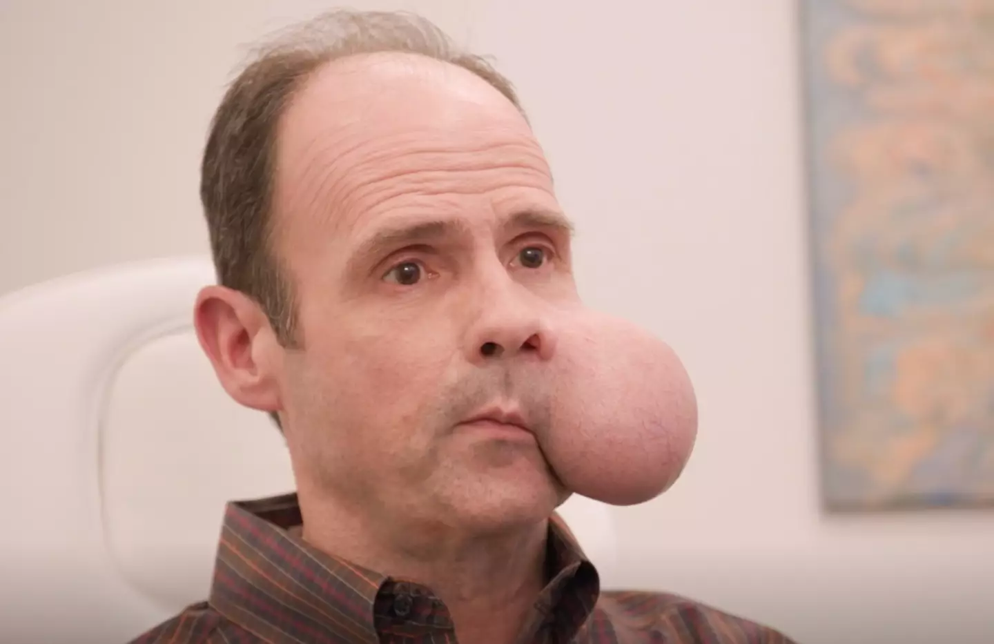 Ron features on TLC's new show 'About Face' (TLC)