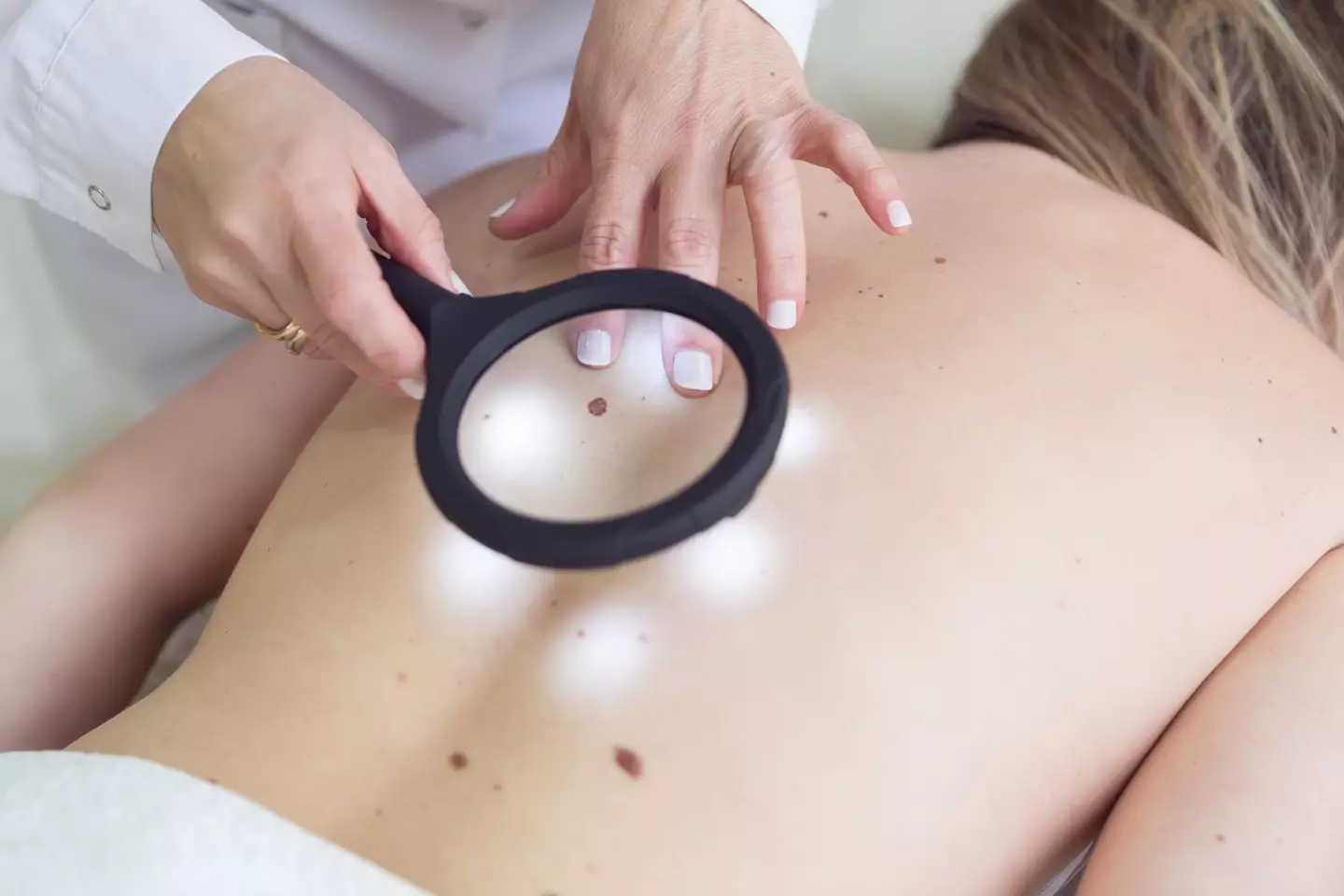 They urged to check for moles (Getty Images)