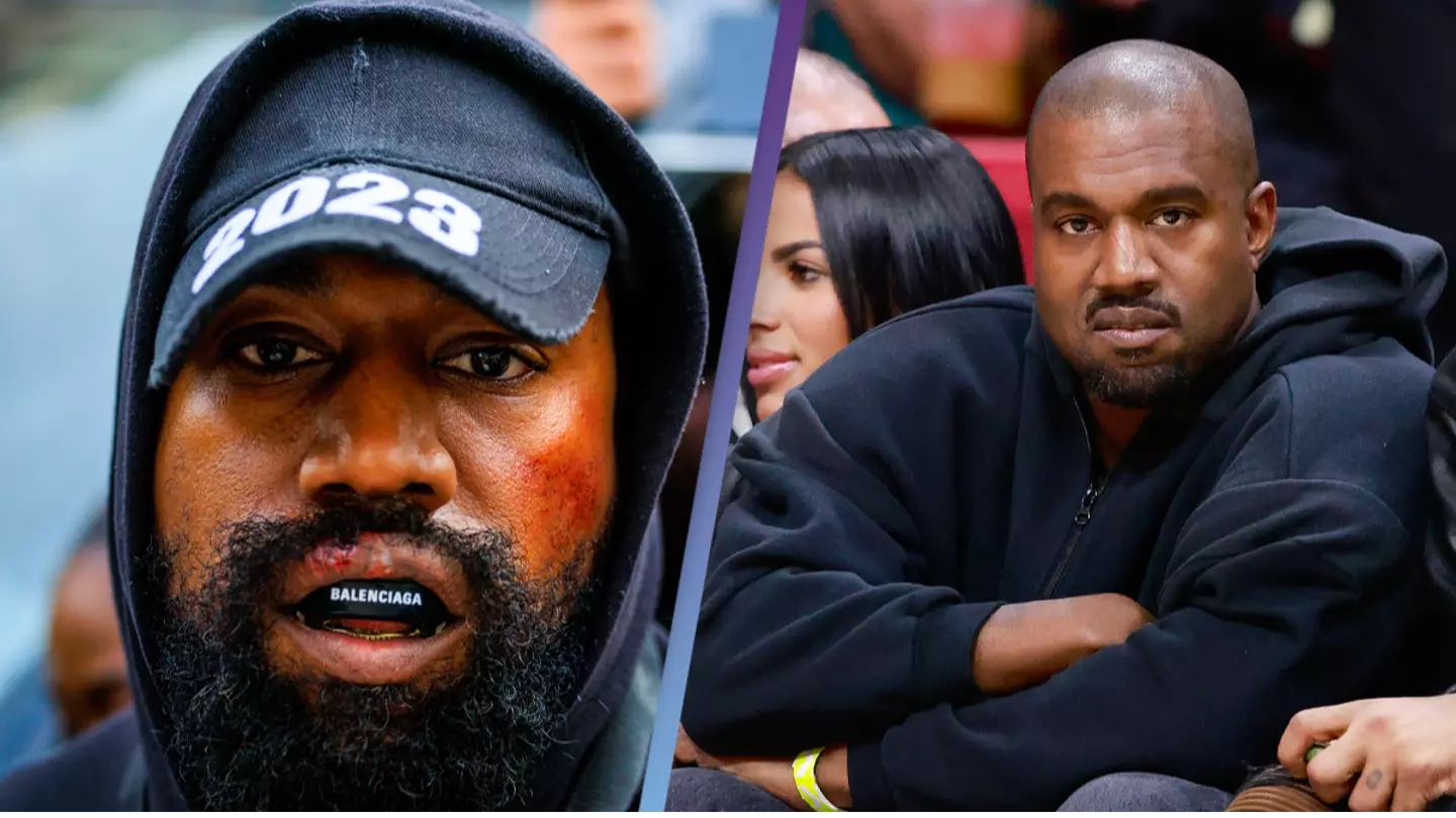 Kanye West says he's been 'beaten to a pulp' after losing $1 billion in deals