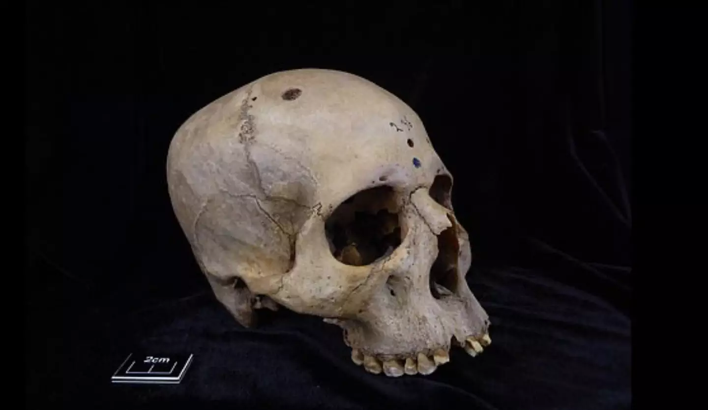 Scientists have examined an 'extraordinary' Egyptian skull. (Tondini, Isidro, Camarós, 2014)
