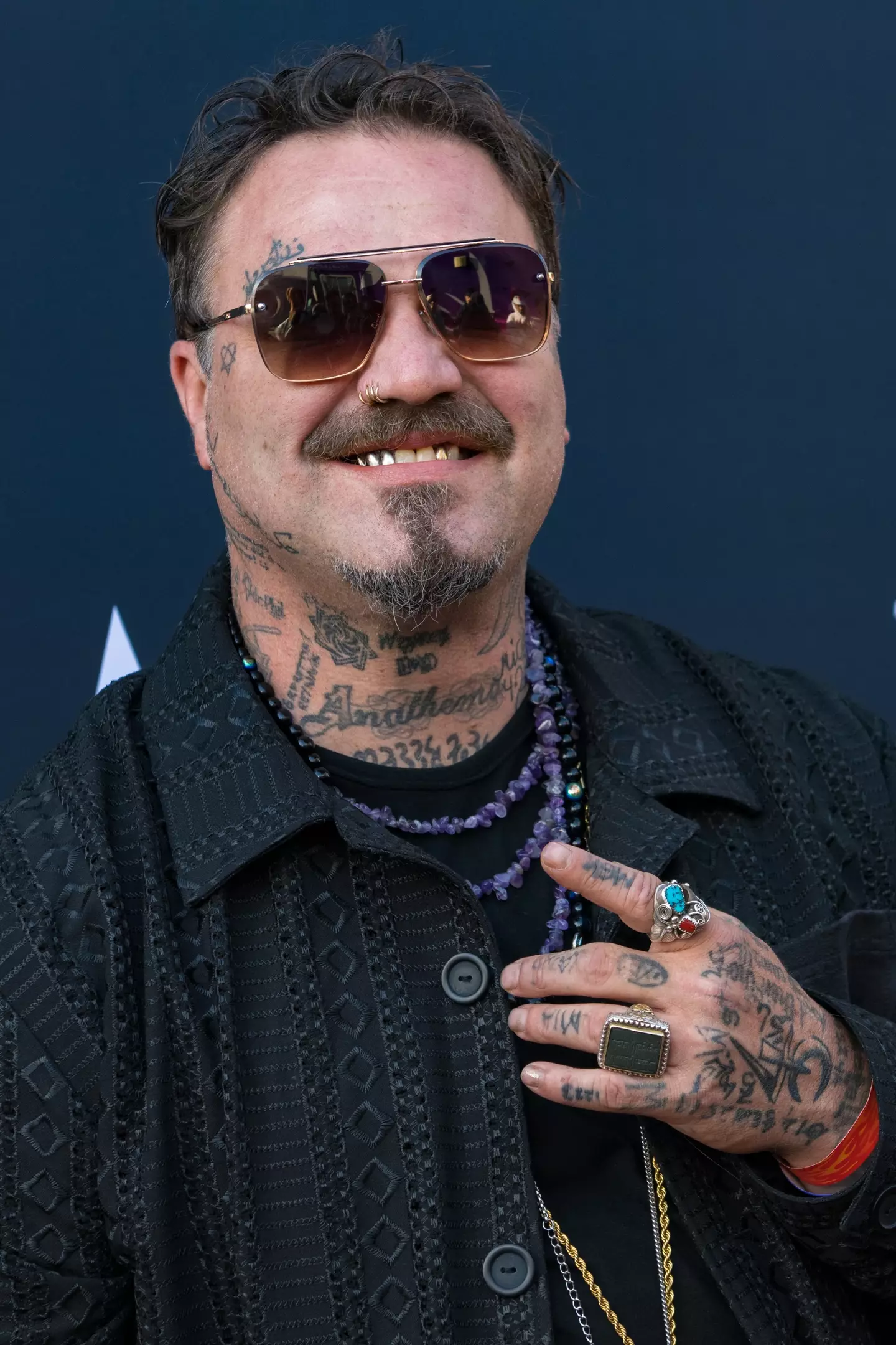 Bam Margera has struggled with his health in recent years (Olivia Wong/Getty Images)