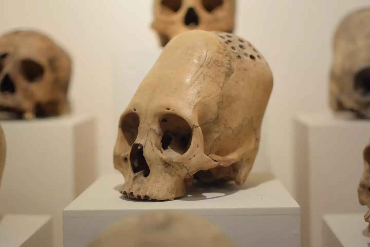 Elongated skull found in Peru (Alamy)