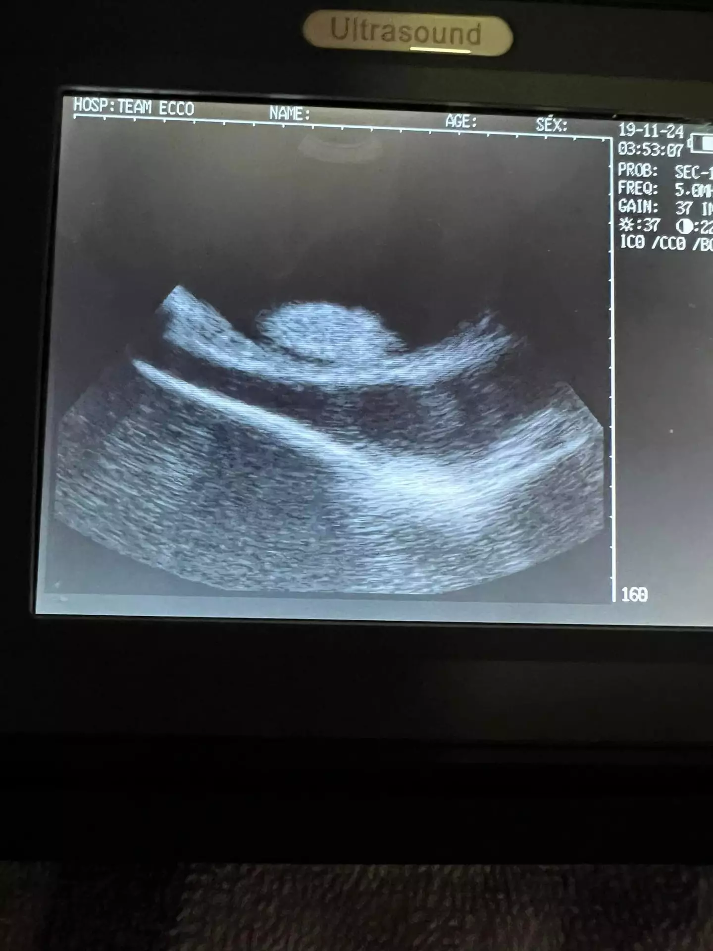 Charlotte's ultrasound.