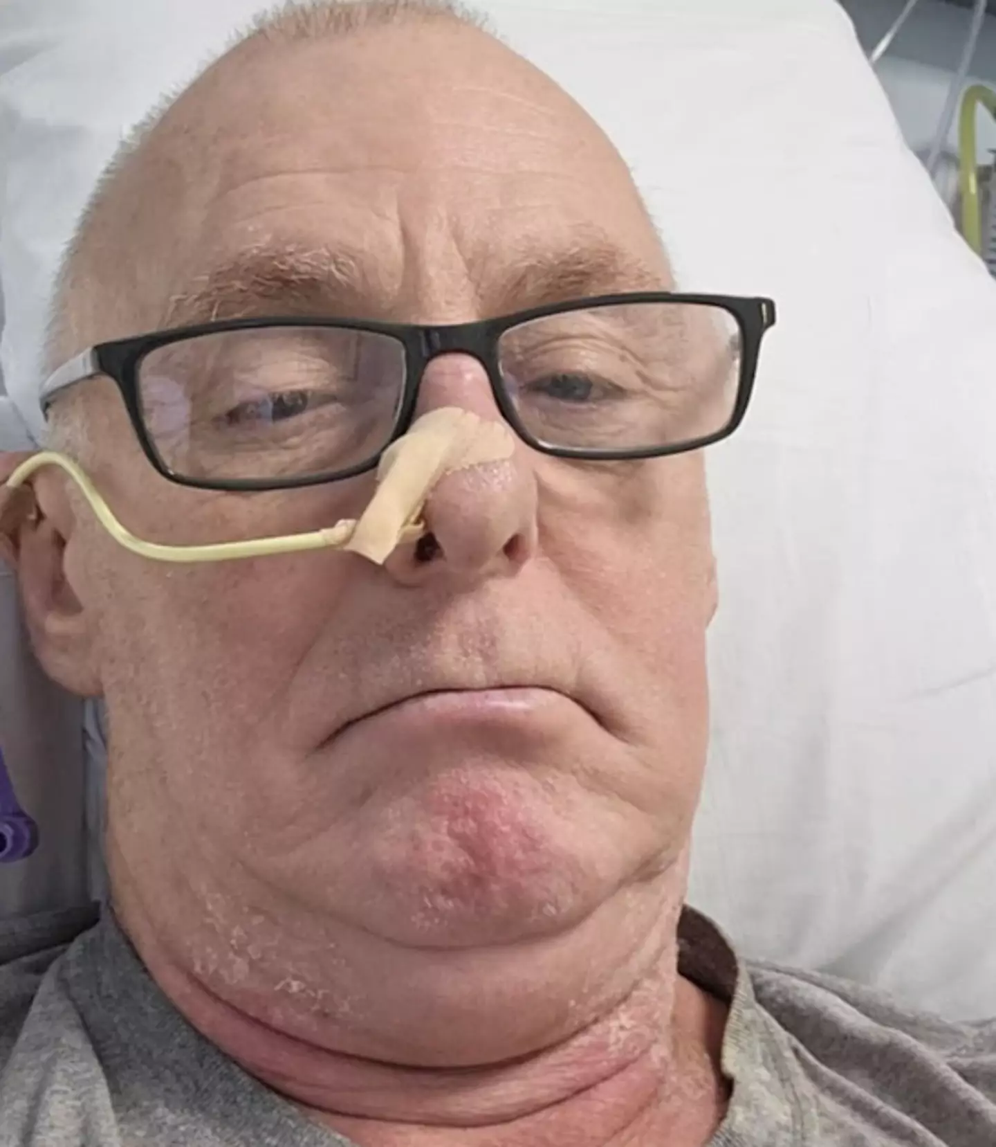 Frank Lane noticed the lump on the right side of his neck (Kennedy News and Media)