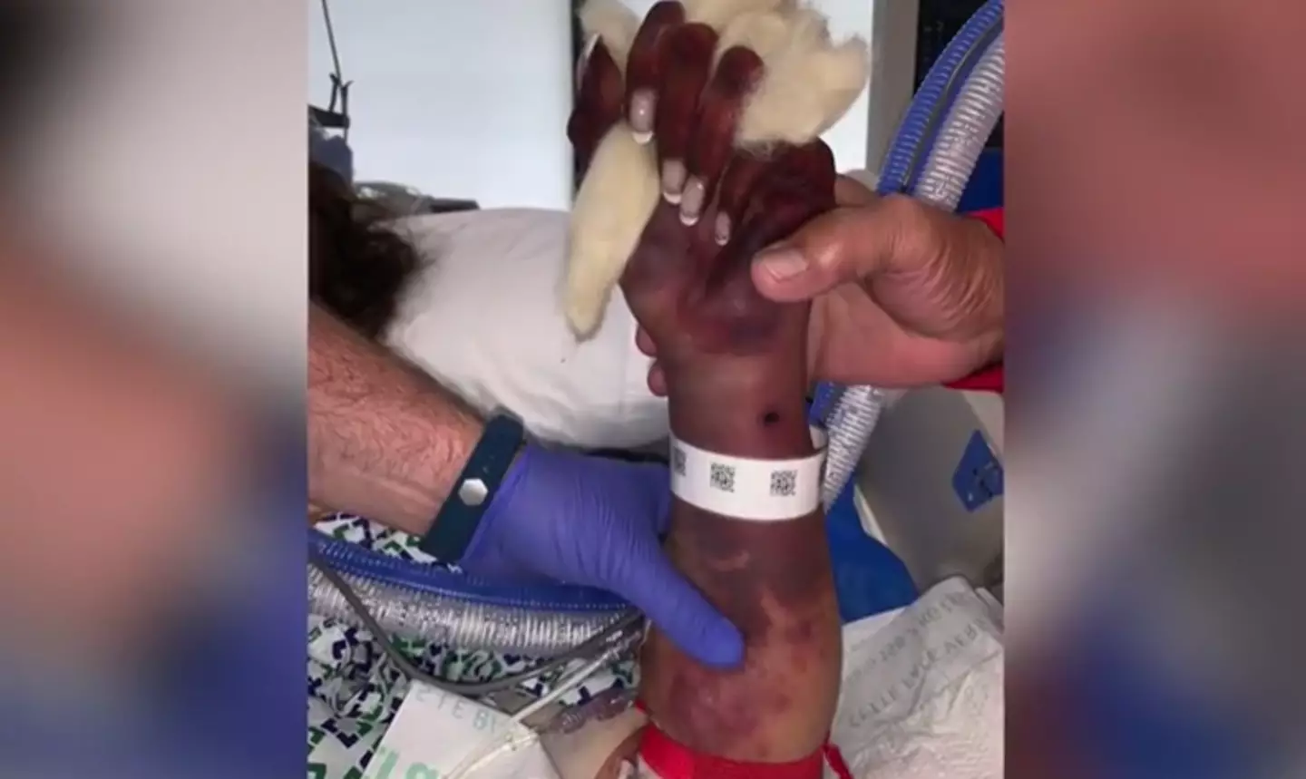 Marie has since been undergoing rehabilitative therapy (Marie Trainer)