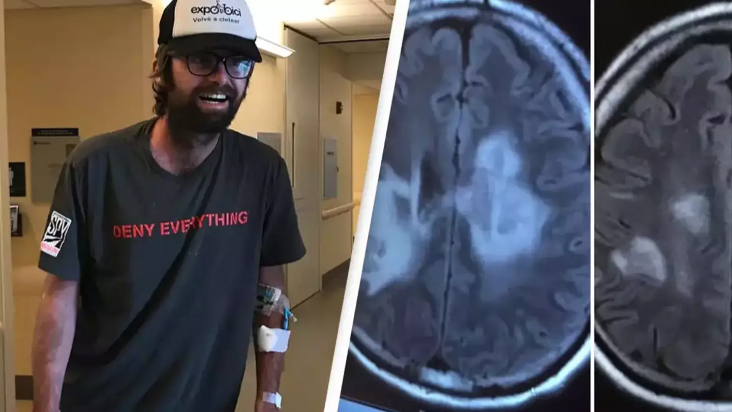 Man who suffered from migraines stunned to discover he actually has condition that only 120 people have ever had