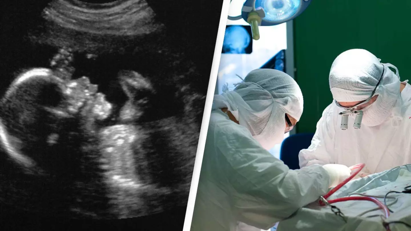 First-of-its-kind brain surgery done on baby inside the womb