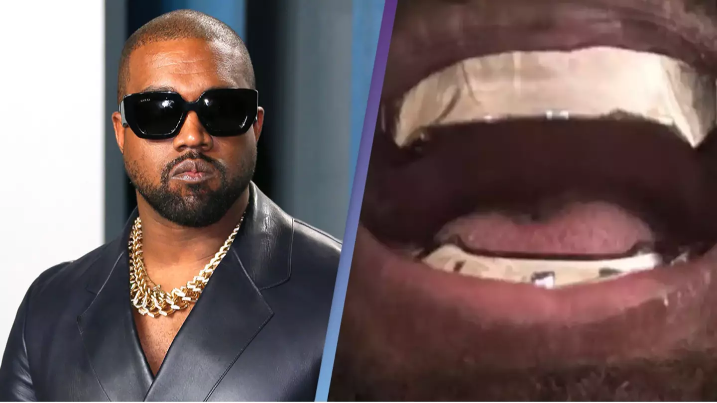 How Kanye West will clean his $850,000 titanium teeth