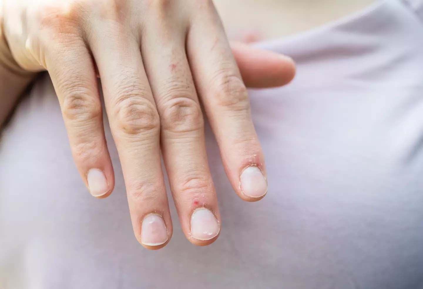 Your nails can show more about your health than you'd think (Getty Stock)