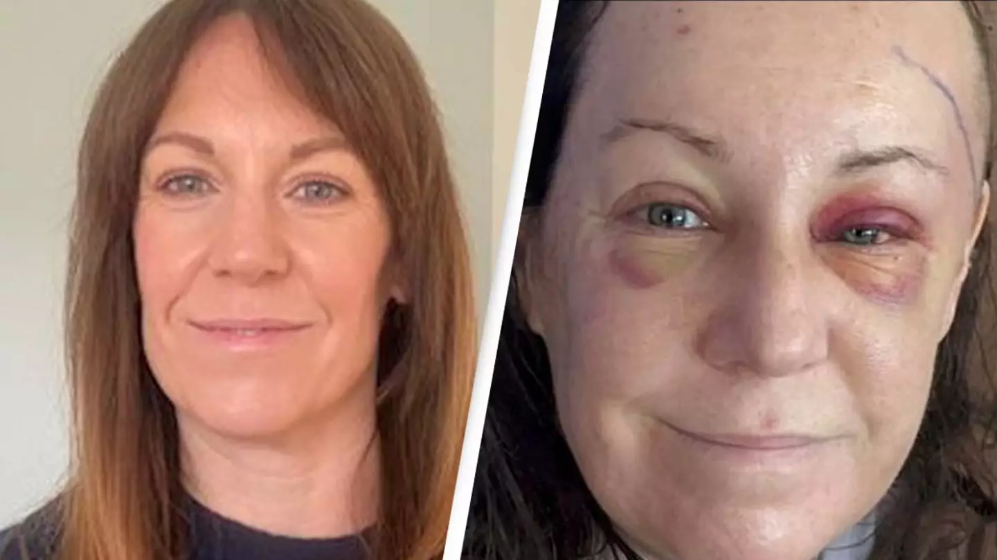 Woman issues warning after routine eye test led to brain tumor diagnosis