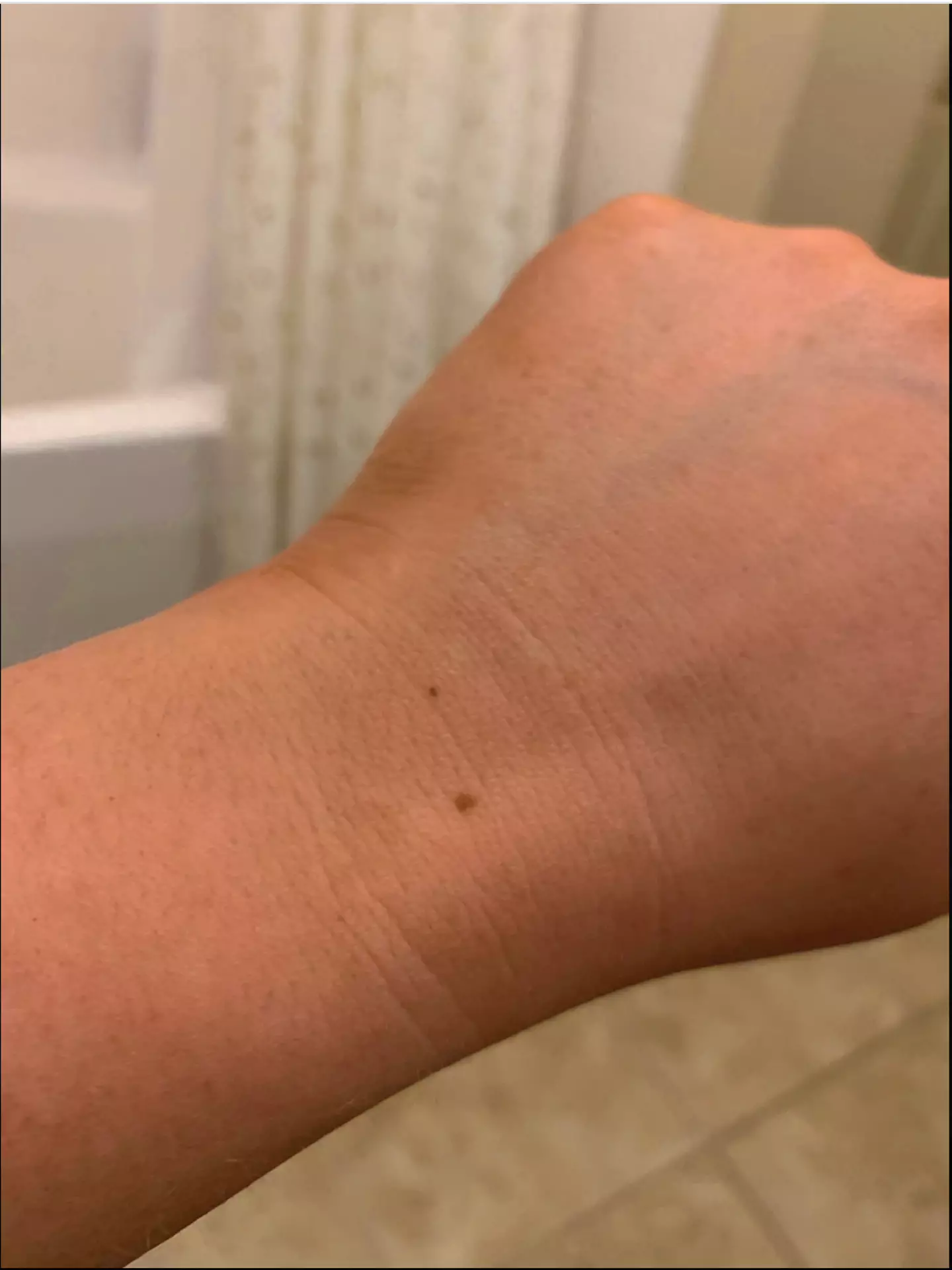 No sci-fi theories behind this little freckle. (Twitter/@KaitNicholexo)