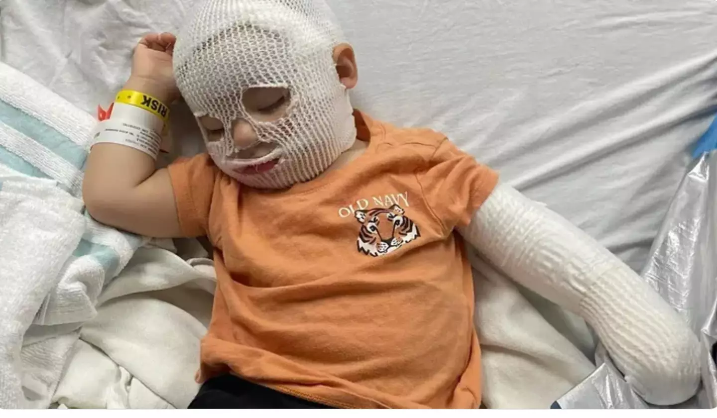 Ryder Flanagan needed surgery for the burns he suffered (GoFundMe)