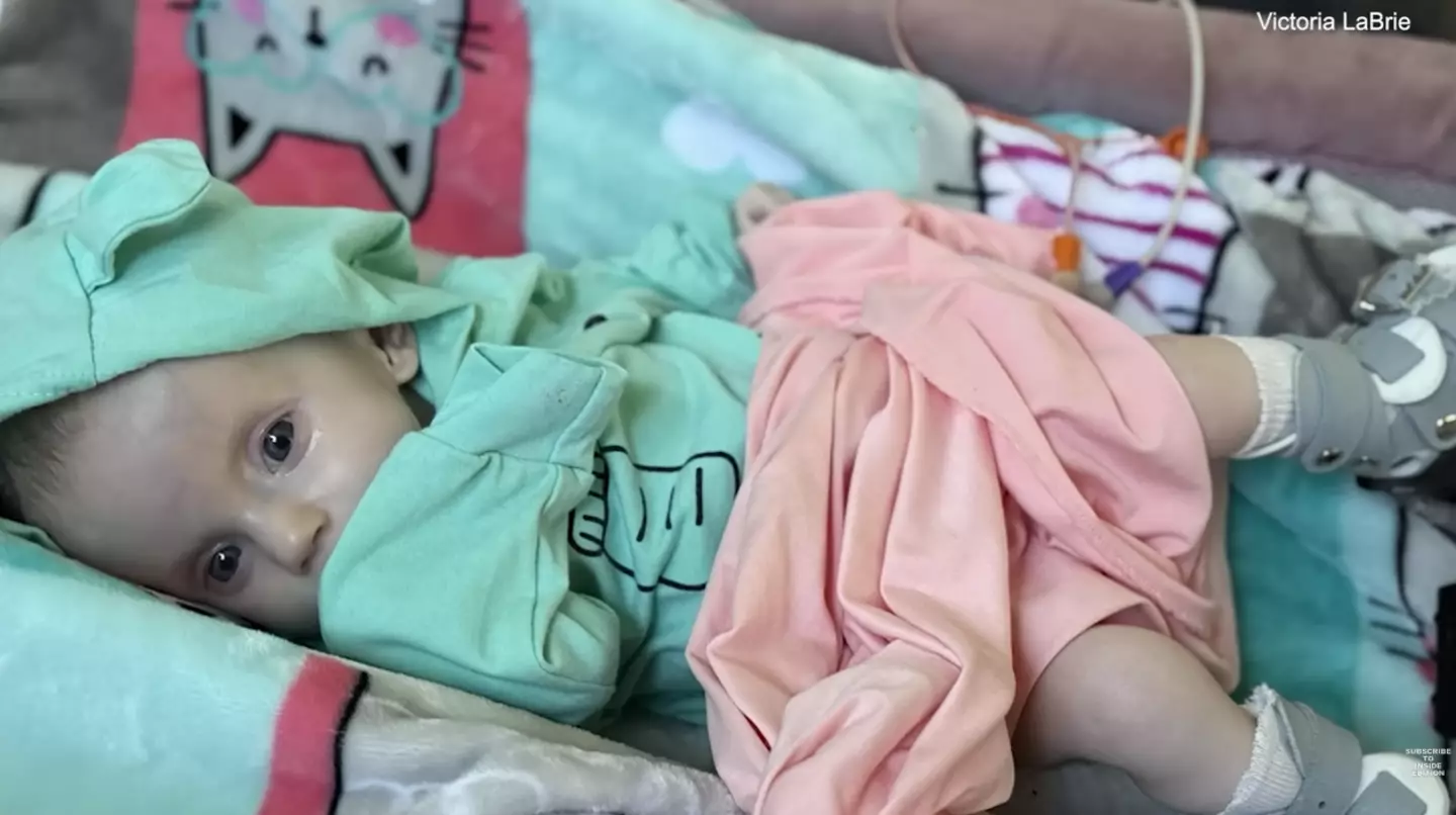 Hazel was born with Moebius syndrome (Inside Edition)