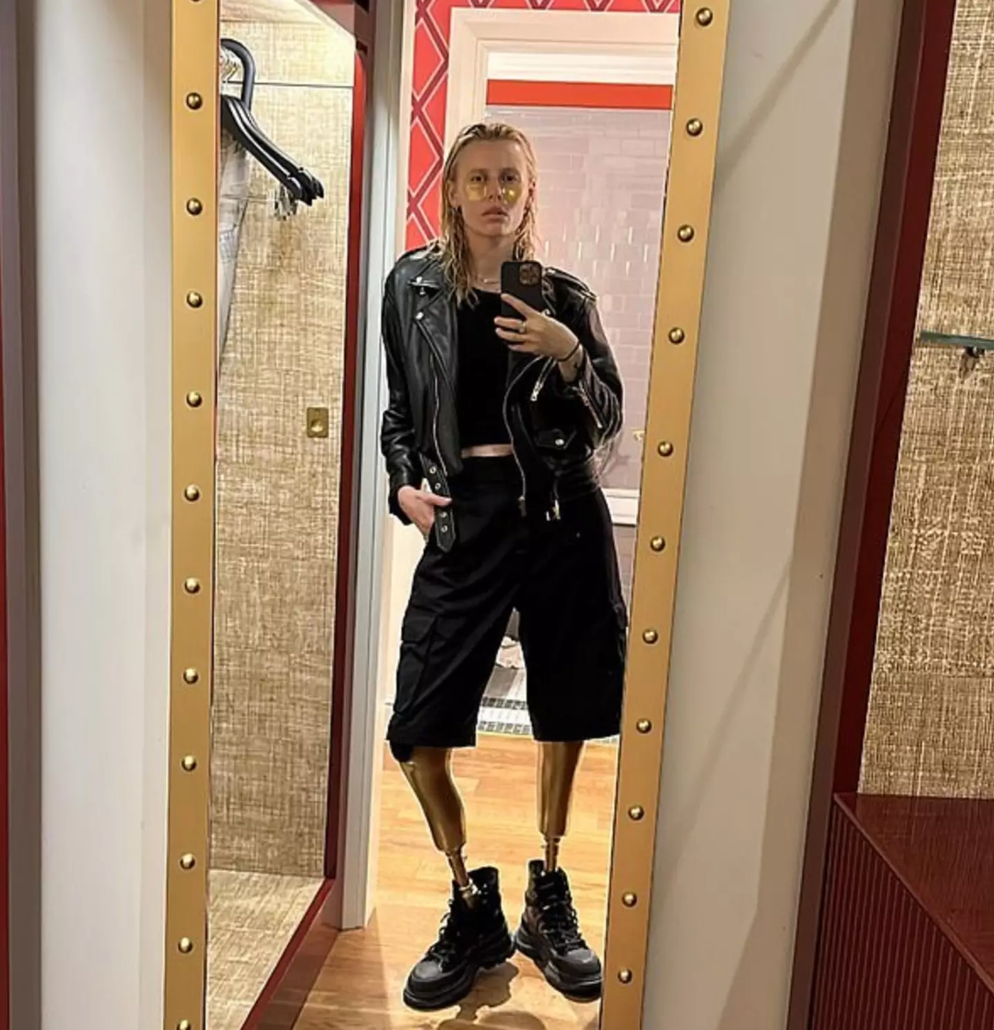 The model had her legs amputated because of TSS. (Instagram/@theimpossiblemuse)