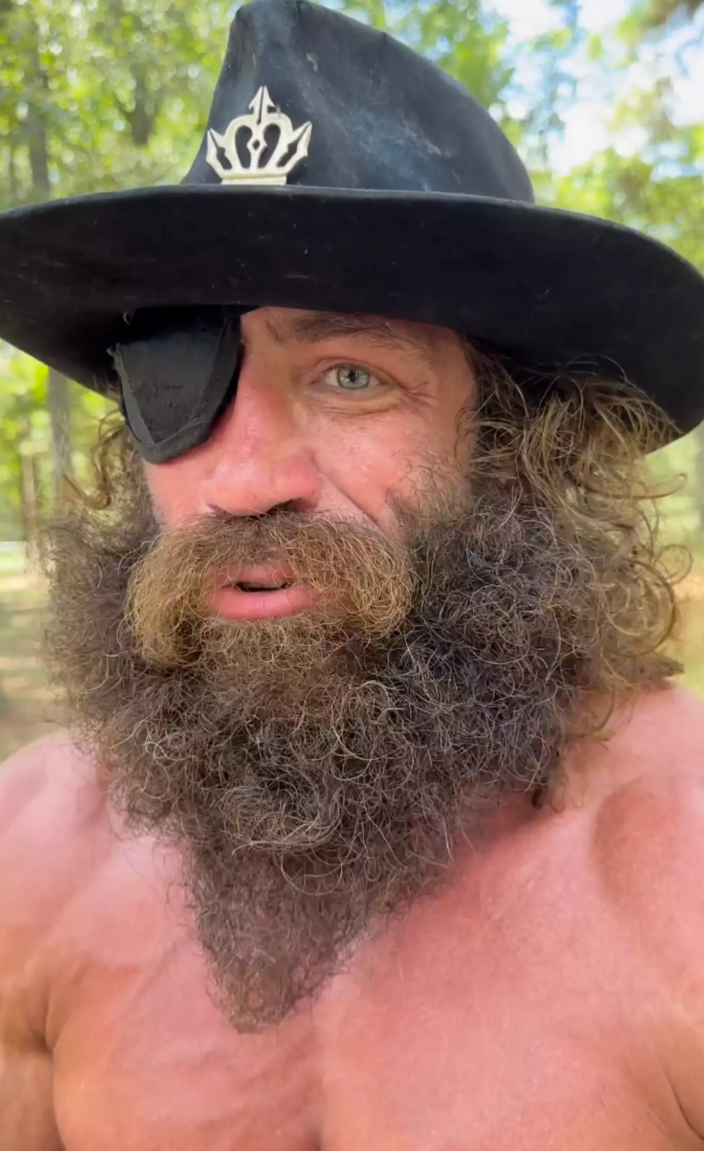 The TikTok star has been spotted with an eye patch in recent videos.