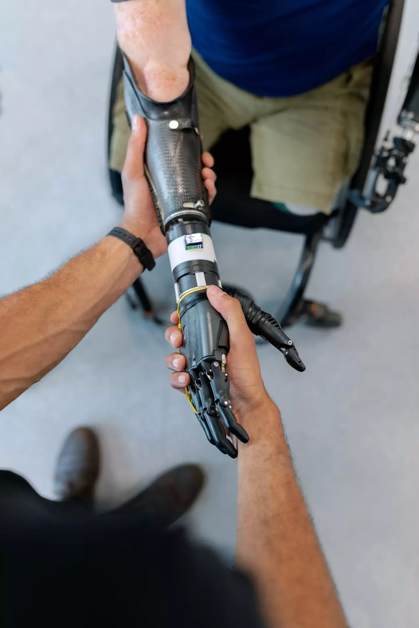 Examples of a BCI include a robotic limb.