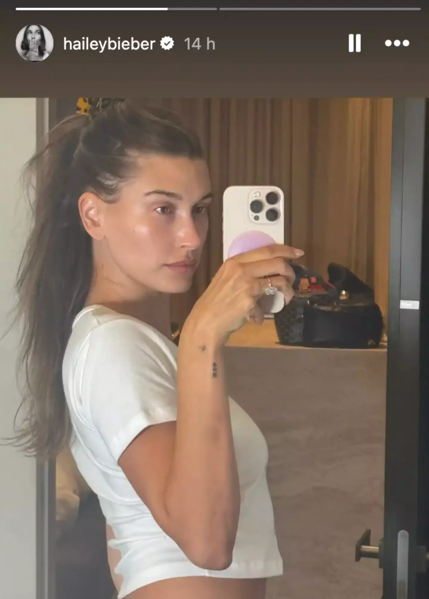 Hailey Bieber shared the selfie on her Instagram Story (Instagram/@haileybieber)