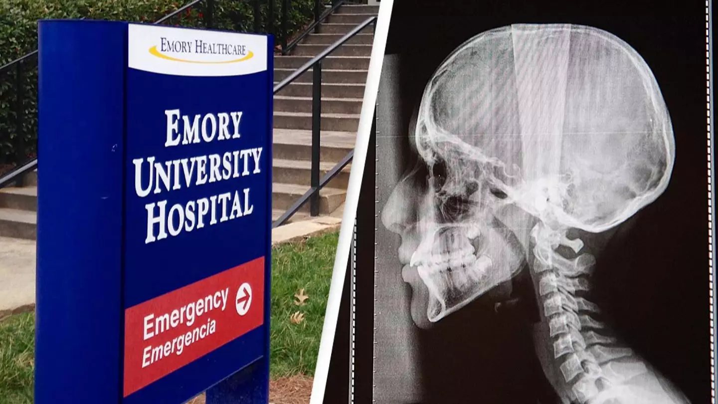 Couple sues hospital after doctors allegedly lose part of patient’s skull during surgery