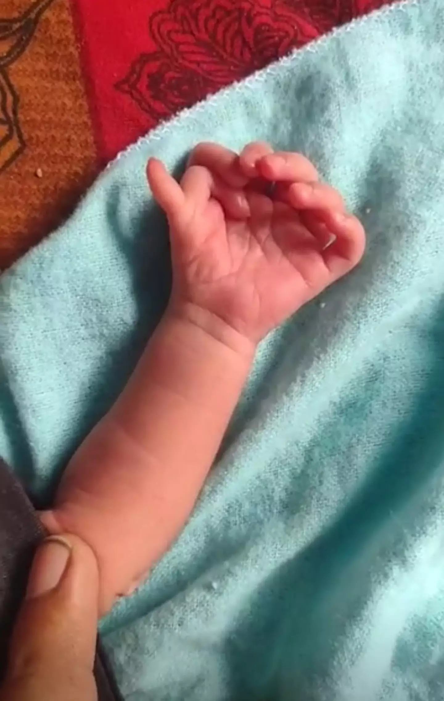 The baby girl has seven fingers on each hand.
