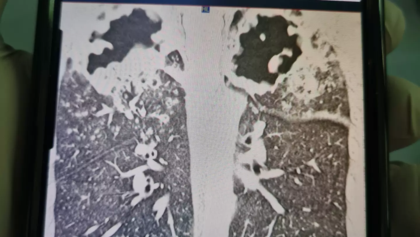 The 'two black areas are the holes' (GoFundMe)