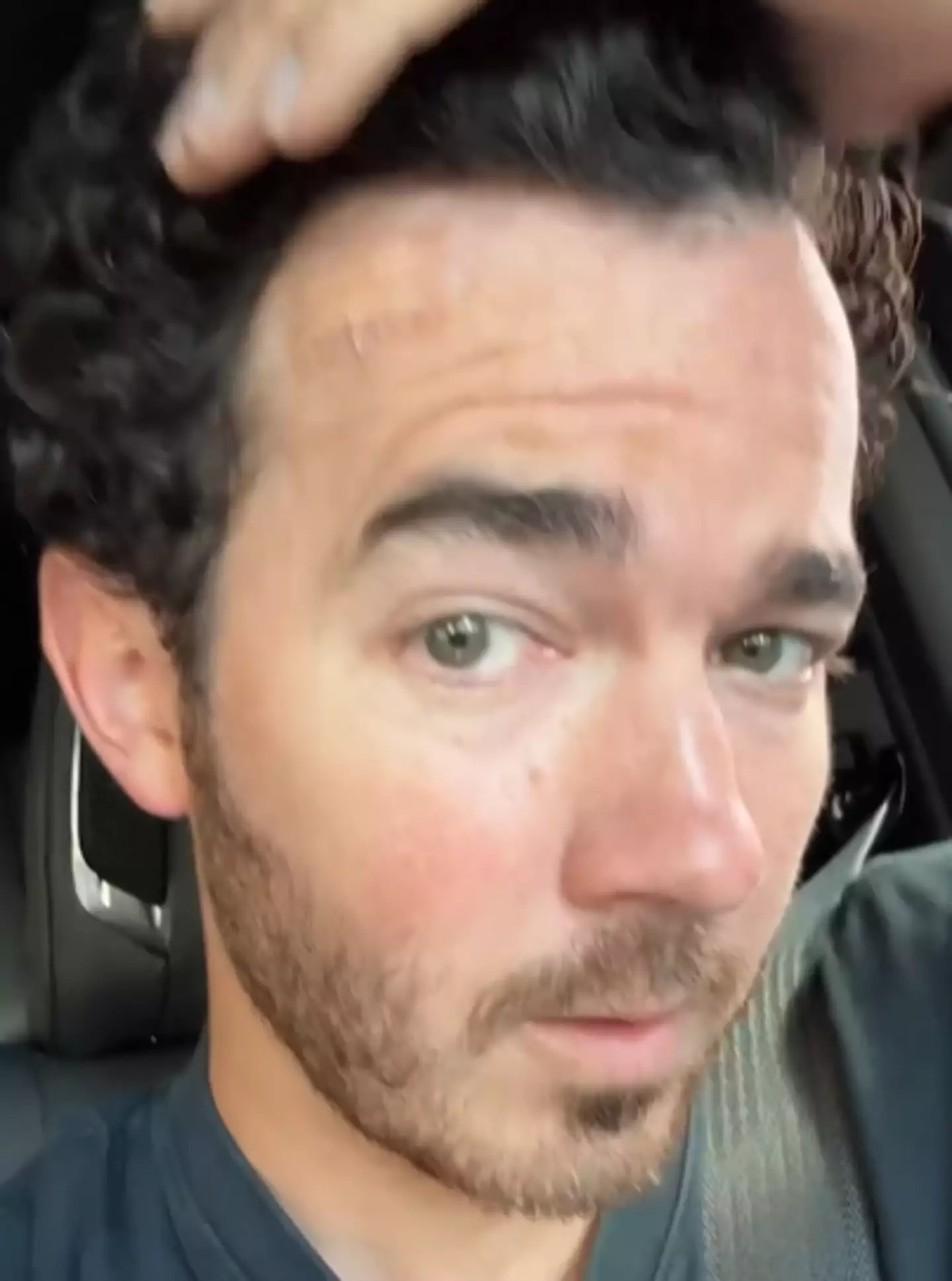 Kevin had his cancerous mole removed (Instagram/ @kevinjonas)
