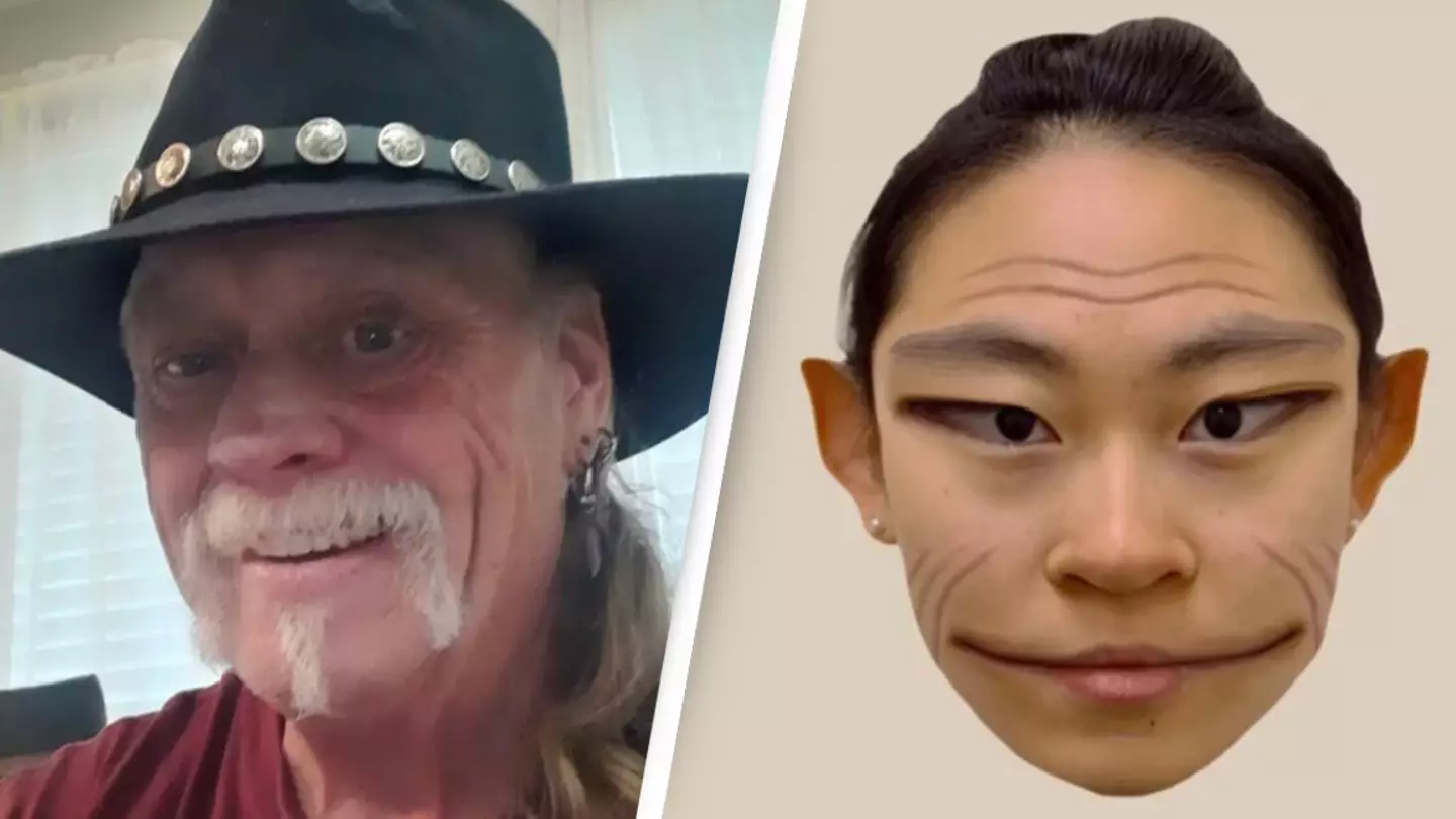 Man lives real-life nightmare with rare condition that makes people look like 'demons'
